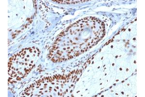 Immunohistochemistry (IHC) image for anti-Nucleophosmin (Nucleolar phosphoprotein B23, Numatrin) (NPM1) (AA 185-287) antibody (ABIN6940216)