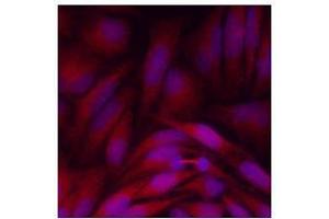 Immunofluorescenitrocellulosee of human HeLa cells stained with Hoechst 3342 (Blue) for nucleus staining and monoclonal anti-human GPC4 antibody (1:500) with Texas Red (Red). (GPC4 antibody  (AA 401-529))