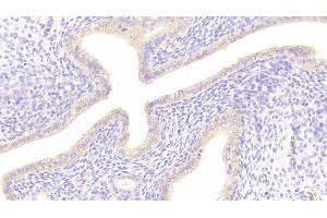 Detection of DKK1 in Rat Uterus Tissue using Polyclonal Antibody to Dickkopf Related Protein 1 (DKK1) (DKK1 antibody  (AA 36-260))
