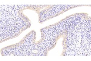 Detection of DKK1 in Rat Uterus Tissue using Polyclonal Antibody to Dickkopf Related Protein 1 (DKK1) (DKK1 antibody  (AA 36-260))