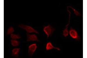 Immunofluorescence (fixed cells) (IF/ICC) image for anti-Inhibitor of kappa Light Polypeptide Gene Enhancer in B-Cells, Kinase beta (IKBKB) (pTyr199) antibody (ABIN6256667)