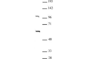 PAF1 antibody (pAb) tested by Western blot. (PAF1/PD2 antibody)