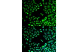 Immunofluorescence analysis of MCF-7 cells using RAD9A antibody. (RAD9A antibody)