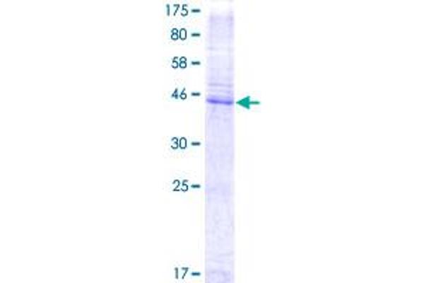 CD151 Protein (CD151) (AA 1-253) (GST tag)