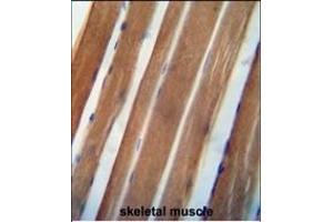 NDUAB antibody (Center) (ABIN654477 and ABIN2844212) immunohistochemistry analysis in formalin fixed and paraffin embedded human skeletal muscle followed by peroxidase conjugation of the secondary antibody and DAB staining. (NDUFA11 antibody  (AA 64-92))