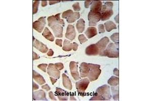 TL1 Antibody (C-term) (ABIN653753 and ABIN2843053) IHC analysis in formalin fixed and raffin embedded skeletal muscle followed by peroxidase conjugation of the secondary antibody and DAB staining. (PATL1 antibody  (C-Term))