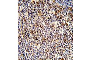 Formalin-fixed and paraffin-embedded human tonsil reacted with KIR3DL3 Antibody (Center) followed which was peroxidase conjugated to the secondary antibody, followed by DAB staining. (KIR3DL3 antibody  (Middle Region))