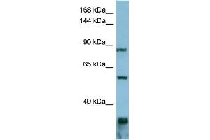 WB Suggested Anti-EPS8  Antibody Titration: 0. (EPS8 antibody  (Middle Region))