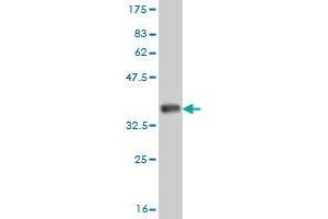 Western Blot detection against Immunogen (35. (ADH6 antibody  (AA 55-144))