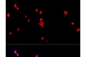 Immunofluorescence analysis of PC-12 cells using EIF2S1 Polyclonal Antibody at dilution of 1:100. (EIF2S1 antibody)