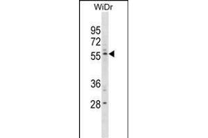 PLXDC1 Antibody (C-term) (ABIN1881662 and ABIN2838412) western blot analysis in WiDr cell line lysates (35 μg/lane). (PLXDC1 antibody  (C-Term))