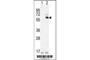 Western blot analysis of KNG1 using rabbit polyclonal KNG1 Antibody using 293 cell lysates (2 ug/lane) either nontransfected (Lane 1) or transiently transfected (Lane 2) with the KNG1 gene.