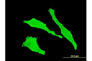 Immunofluorescence of monoclonal antibody to TGOLN2 on HeLa cell. (TGOLN2 antibody  (AA 229-327))