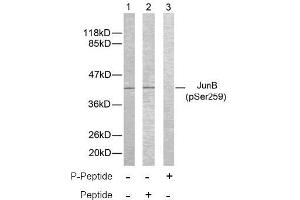 Image no. 2 for anti-Jun B Proto-Oncogene (JUNB) (pSer259) antibody (ABIN196659) (JunB antibody  (pSer259))