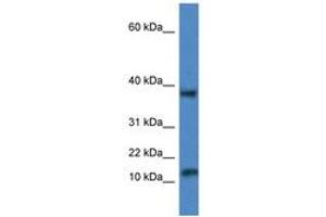 Image no. 1 for anti-Vesicle-Associated Membrane Protein 1 (Synaptobrevin 1) (VAMP1) (AA 53-102) antibody (ABIN6747255) (VAMP1 antibody  (AA 53-102))