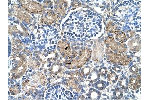 GLS2 antibody was used for immunohistochemistry at a concentration of 4-8 ug/ml. (GLS2 antibody)