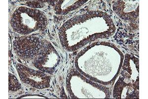 Image no. 18 for anti-Ubiquitin-Conjugating Enzyme E2, J1, U (UBE2J1) antibody (ABIN1501637)