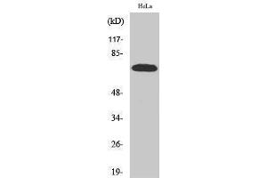 Western Blotting (WB) image for anti-Ribosomal Protein S6 Kinase, 70kDa, Polypeptide 1 (RPS6KB1) (Tyr1003) antibody (ABIN3186298) (RPS6KB1 antibody  (Tyr1003))