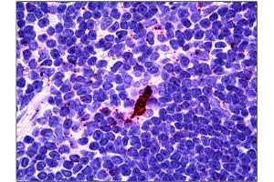 Immunohistochemistry (IHC) image for anti-Interleukin-27 subunit beta (IL-27b) antibody (ABIN781990) (EBI3 antibody)