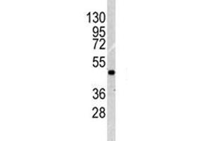 Western blot analysis of ILK1 antibody and NCI-H460 lysate. (ILK antibody  (AA 151-180))