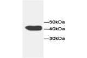 Image no. 1 for anti-Flavin Reductase (BLVRB) antibody (ABIN791536) (BLVRB antibody)