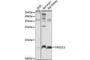 Western blot analysis of extracts of various cell lines, using TPD52L3 antibody (ABIN6292309) at 1:1000 dilution.