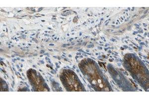 ABIN6274601 at 1/100 staining Mouse intestine tissue by IHC-P. (CDH22 antibody  (N-Term))