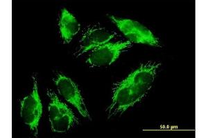 Immunofluorescence of purified MaxPab antibody to HIBADH on HepG2 cell. (HIBADH antibody  (AA 1-336))