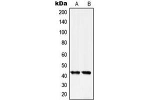 Western Blotting (WB) image for anti-serpin Peptidase Inhibitor, Clade B (Ovalbumin), Member 5 (SERPINB5) (Center) antibody (ABIN7296588)