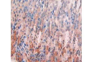 Used in DAB staining on fromalin fixed paraffin- embedded stomach tissue (GPC4 antibody  (AA 220-426))