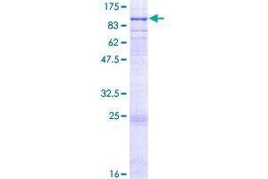 Image no. 1 for UDP-N-Acetyl-alpha-D-Galactosamine:polypeptide N-Acetylgalactosaminyltransferase 6 (GalNAc-T6) (GALNT6) (AA 1-622) protein (GST tag) (ABIN1354750)