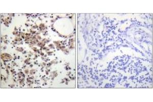 Immunohistochemistry analysis of paraffin-embedded human lymph node, using SYK (Phospho-Tyr323) Antibody. (SYK antibody  (pTyr323))