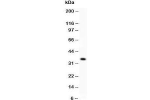 Western blot testing of KLF6 antibody and recombinant human protein (0. (KLF6 antibody  (AA 38-205))