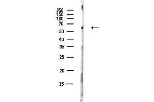anti-Cysteinyl-tRNA Synthetase 2, Mitochondrial (Putative) (CARS2) antibody
