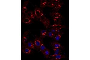 Confocal immunofluorescence analysis of Hela cells using GM130 antibody (ABIN6129789, ABIN6141264, ABIN6141265 and ABIN6220979) at dilution of 1:400. (Golgin A2 (GOLGA2) (AA 20-300) antibody)