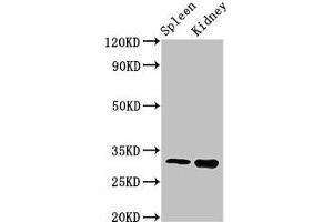 Western Blot Positive WB detected in: Mouse spleen tissue, Mouse kidney tissue All lanes: ABT1 antibody at 3 μg/mL Secondary Goat polyclonal to rabbit IgG at 1/50000 dilution Predicted band size: 32 kDa Observed band size: 32 kDa (Activator of Basal Transcription 1 antibody  (AA 197-270))