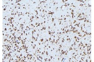 ABIN6279159 at 1/100 staining Mouse brain tissue by IHC-P. (ABCA3 antibody  (Internal Region))