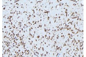 ABIN6279159 at 1/100 staining Mouse brain tissue by IHC-P.