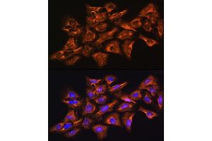 Immunofluorescence analysis of U-2 OS cells using GNB1 Rabbit pAb (ABIN6129389, ABIN6141219, ABIN6141220 and ABIN6219000) at dilution of 1:100 (40x lens). (GNB1 antibody  (AA 1-340))
