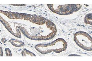 ABIN6279191 at 1/100 staining Human prostate tissue by IHC-P. (BAAT antibody  (N-Term))