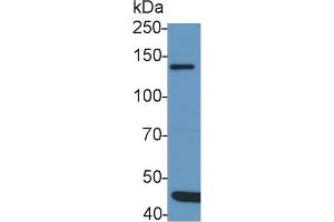Detection of IRS1 in Rat Cerebrum lysate using Polyclonal Antibody to Insulin Receptor Substrate 1 (IRS1) (IRS1 antibody  (AA 837-1089))