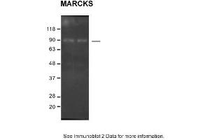 Sample: SH-SY5Y cells 2. (MARCKS antibody  (C-Term))