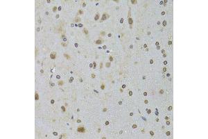 Immunohistochemistry of paraffin-embedded rat brain using DDX1 Antibody. (DDX1 antibody  (AA 441-740))