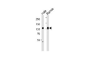 Western blot analysis of lysates from Hela, Ramos cell line (from left to right), using SP1 Antibody (ABIN1944791 and ABIN2838536). (SP1 antibody  (AA 1-250))