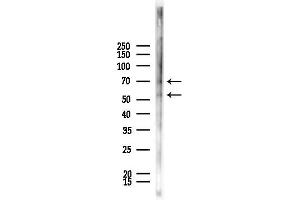 Western blot analysis of lysates from Rat lung, using Phospho-TFEB (Ser211) Antibody at 1/1000 dilution.
