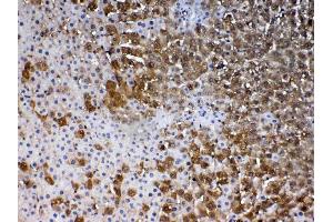 Immunohistochemistry (IHC) image for anti-Parkinson Protein 7 (PARK7) (AA 2-189) antibody (ABIN5519050)