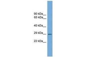 Image no. 1 for anti-BARX Homeobox 2 (BARX2) (AA 31-80) antibody (ABIN6744580) (BARX Homeobox 2 antibody  (AA 31-80))