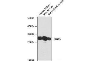 Western blot analysis of extracts of various cell lines using DOK5 Polyclonal Antibody at dilution of 1:3000. (DOK5 antibody)