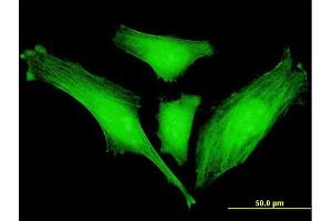 Immunofluorescence of monoclonal antibody to SLC2A4RG on HeLa cell. (SLC2A4RG antibody  (AA 178-269))