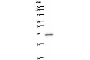 Western Blotting (WB) image for anti-Nuclear Receptor Binding SET Domain Protein 1 (NSD1) antibody (ABIN932477) (NSD1 antibody)